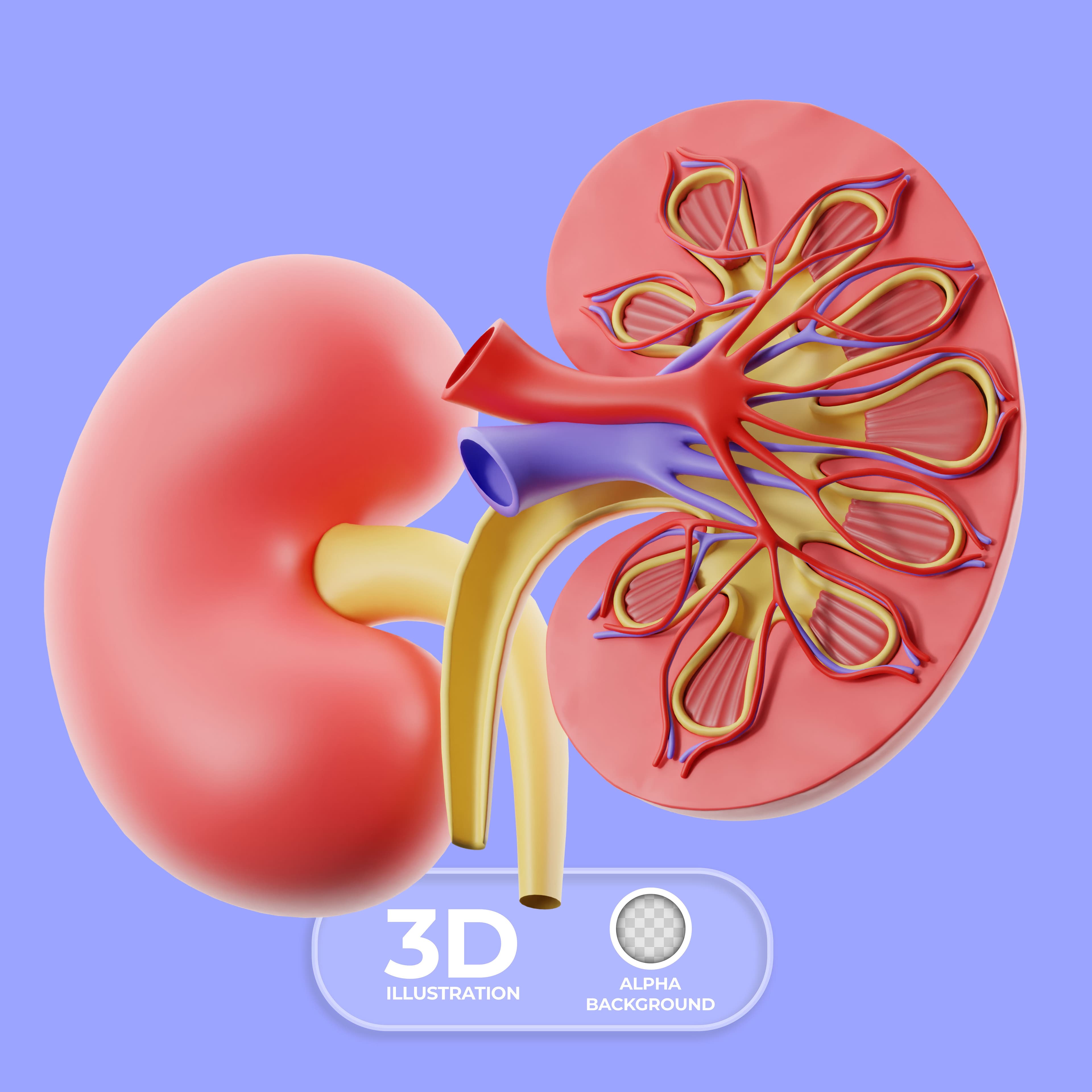 Kidney Transplant